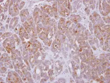 Anti-G protein alpha 16 antibody used in IHC (Paraffin sections) (IHC-P). GTX118385