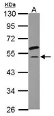 Anti-EIF2S3 antibody [N1C1] used in Western Blot (WB). GTX118389