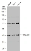 Anti-PRAS40 antibody used in Western Blot (WB). GTX118391