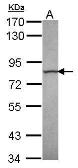 Anti-Calpain 13 antibody [C1C3] used in Western Blot (WB). GTX118394