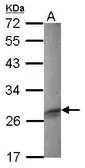 Anti-FHL3 antibody [N1C3-2] used in Western Blot (WB). GTX118404