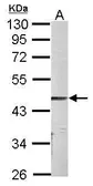 Anti-Parvin alpha antibody used in Western Blot (WB). GTX118414