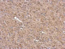 Anti-TMF1 antibody used in IHC (Paraffin sections) (IHC-P). GTX118432