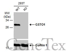 Anti-GSTO1 antibody used in Western Blot (WB). GTX118439