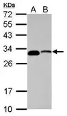 Anti-CENPP antibody used in Western Blot (WB). GTX118443