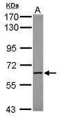 Anti-MTMR9 antibody used in Western Blot (WB). GTX118447