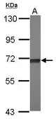 Anti-TKTL2 antibody [N1N3] used in Western Blot (WB). GTX118468