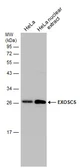 Anti-EXOSC5 antibody used in Western Blot (WB). GTX118473