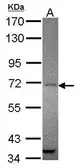 Anti-AMOT antibody [N3C1], Internal used in Western Blot (WB). GTX118474
