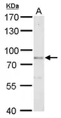 Anti-DBC1 antibody [N1N2], N-term used in Western Blot (WB). GTX118477