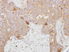 Anti-DCI antibody [N1C2] used in IHC (Paraffin sections) (IHC-P). GTX118478