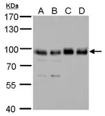 Anti-SNX25 antibody [N2C1], Internal used in Western Blot (WB). GTX118491