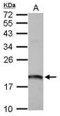 Anti-ARL1 antibody used in Western Blot (WB). GTX118495