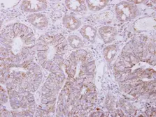 Anti-PIGO antibody [N2N3] used in IHC (Paraffin sections) (IHC-P). GTX118512
