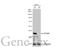 Anti-PTGR1 antibody [N1C2] used in Western Blot (WB). GTX118527