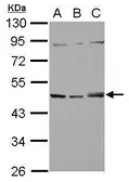 Anti-SNX5 antibody [N2C2], Internal used in Western Blot (WB). GTX118542