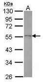 Anti-HIP55 antibody [N1N3] used in Western Blot (WB). GTX118543