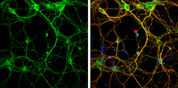 Anti-Syntaxin 3 antibody [N1C2] used in Immunocytochemistry/ Immunofluorescence (ICC/IF). GTX118549