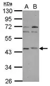 Anti-p40 antibody used in Western Blot (WB). GTX118551