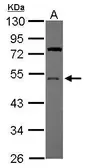 Anti-UBA5 antibody [N1C1] used in Western Blot (WB). GTX118552