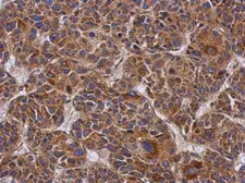 Anti-Ymer antibody used in IHC (Paraffin sections) (IHC-P). GTX118557