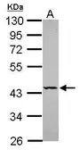 Anti-SEPT5 antibody [N3C3] used in Western Blot (WB). GTX118561