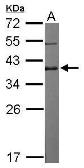 Anti-DPPA4 antibody [N1C3] used in Western Blot (WB). GTX118569