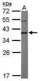 Anti-DPPA4 antibody [N1C3] used in Western Blot (WB). GTX118569