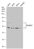 Anti-Plxdc2 antibody [N1C1] used in Western Blot (WB). GTX118575