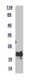 Human RPL26 protein, His tag. GTX118577-pro