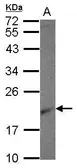 Anti-RPL26 antibody used in Western Blot (WB). GTX118577