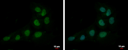 Anti-ZNF326 antibody [N1C1] used in Immunocytochemistry/ Immunofluorescence (ICC/IF). GTX118581