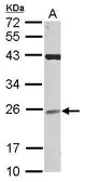 Anti-NCE2 antibody [N1C3] used in Western Blot (WB). GTX118584