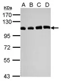 Anti-USP13 antibody [C2C3], C-term used in Western Blot (WB). GTX118595