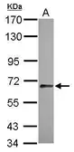 Anti-SLITRK1 antibody [C1C3] used in Western Blot (WB). GTX118596