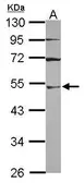 Anti-UBA3 antibody [N1N3] used in Western Blot (WB). GTX118601