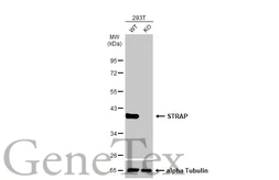 Anti-STRAP antibody [N1C3] used in Western Blot (WB). GTX118603