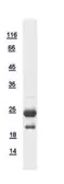 Human IRGM protein, His tag. GTX118613-pro