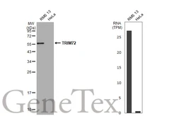 Anti-TRIM72 antibody used in Western Blot (WB). GTX118625