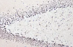 Anti-NFIX antibody [N2C2], Internal used in IHC (Paraffin sections) (IHC-P). GTX118630