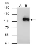 Anti-WBP11 antibody used in Immunoprecipitation (IP). GTX118654
