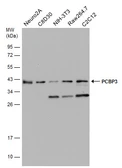 Anti-PCBP3 antibody [N1C2] used in Western Blot (WB). GTX118656