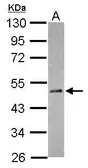 Anti-RBM41 antibody [N3C3] used in Western Blot (WB). GTX118659