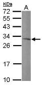 Anti-MRPL10 antibody [N2C3] used in Western Blot (WB). GTX118663