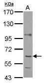 Anti-P4HA1 antibody [C1C3] used in Western Blot (WB). GTX118673
