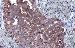 Anti-P4HA1 antibody [C1C3] used in IHC (Paraffin sections) (IHC-P). GTX118673