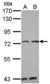 Anti-KIAA0020 antibody [C1C3] used in Western Blot (WB). GTX118675