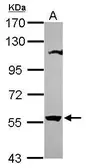 Anti-OASL antibody [N3C3] used in Western Blot (WB). GTX118680