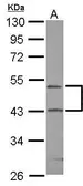 Anti-RPIP8 antibody [N1C1] used in Western Blot (WB). GTX118684