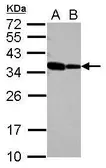 Anti-RBM11 antibody [N2C3] used in Western Blot (WB). GTX118694